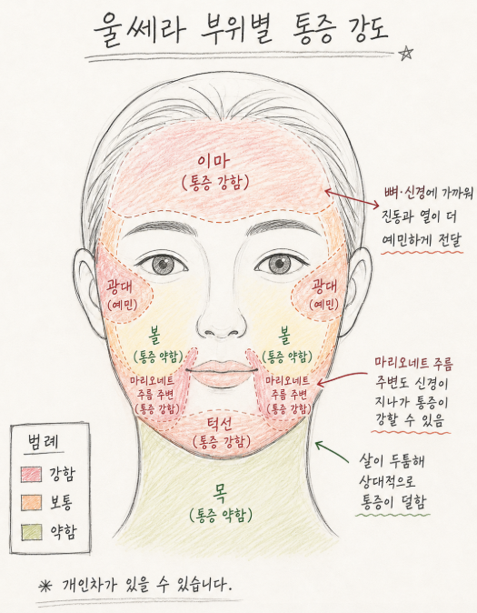 울쎄라 통증, 얼마나 아플까요? 부위별 느낌과 마취 방법 3가지