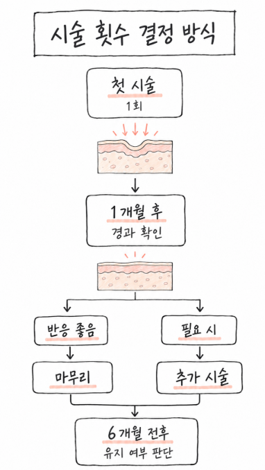 고우리 몇번 받아야 하는지 시술 횟수 결정 방식에 대한 도식