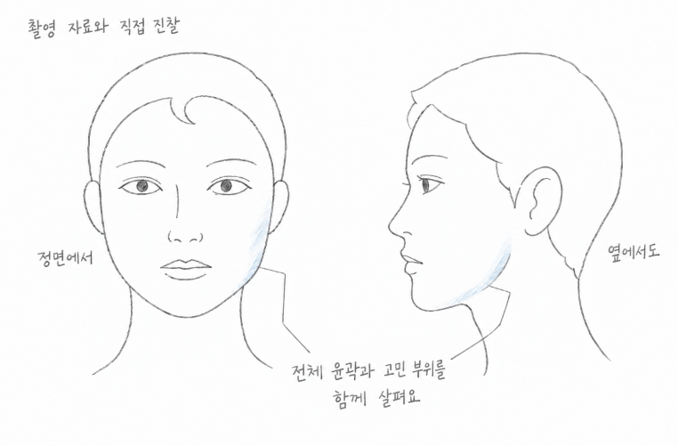 같은 얼굴의 정면과 측면을 나란히 그려, 촬영 자료와 직접 진찰로 전체 윤곽과 고민 부위를 함께 살펴보는 손그림.