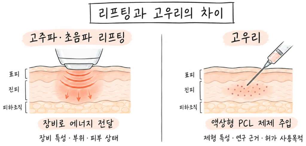 에너지 기반 리프팅과 액상형 PCL 고우리의 시술 방식 및 고우리의 국내 허가 사용목적을 비교한 그림
