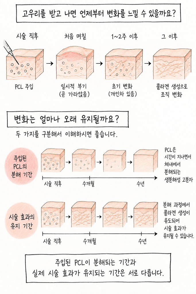 고우리는 몇 번 맞아야 하나요? 시술 횟수와 유지기간