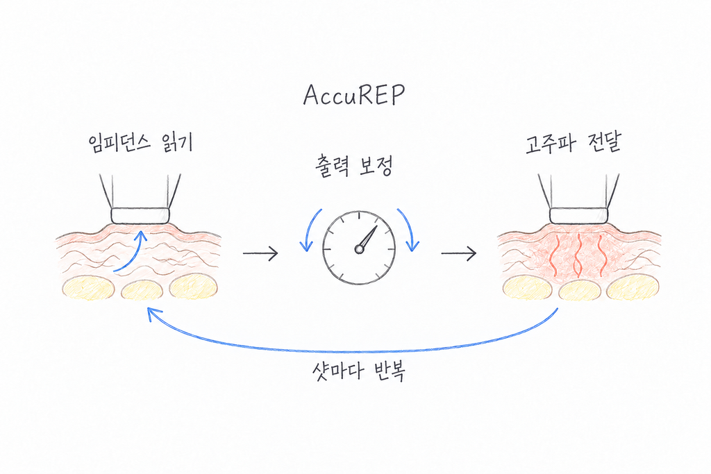 임피던스 판독, 출력 보정, 고주파 전달을 샷마다 반복하는 AccuREP 순환 도식.