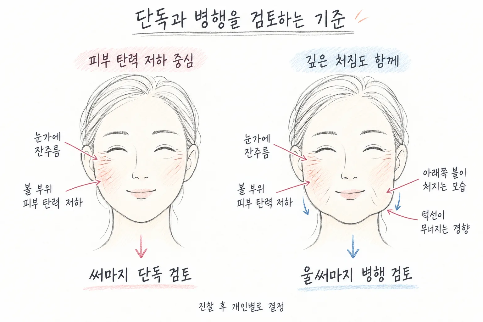 울쎄라 써마지 차이, 울써마지 병행은 어떤 얼굴에서 고려할까요?