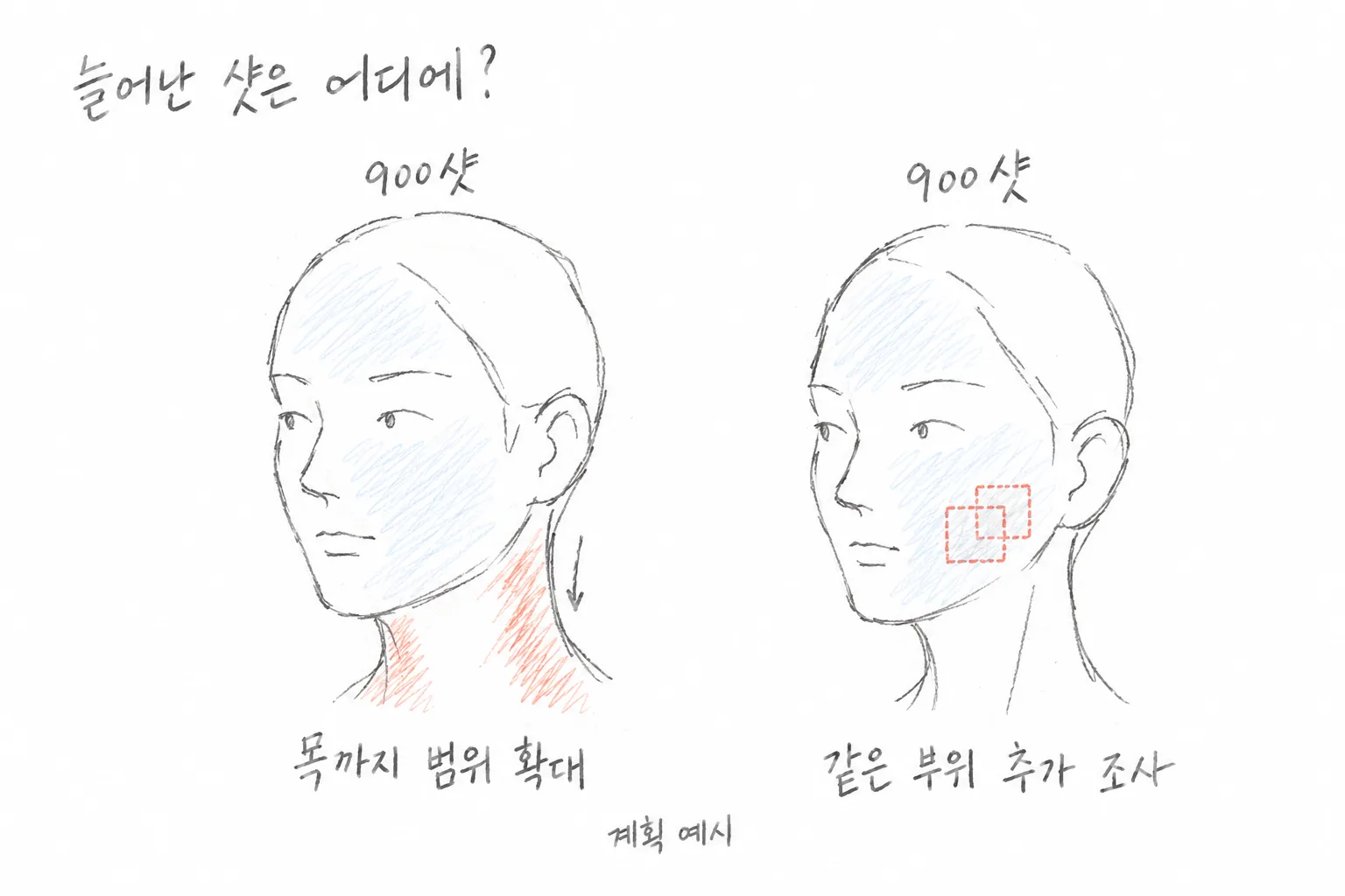 써마지 가격, 300샷·600샷·900샷 비교 전에 확인할 조건