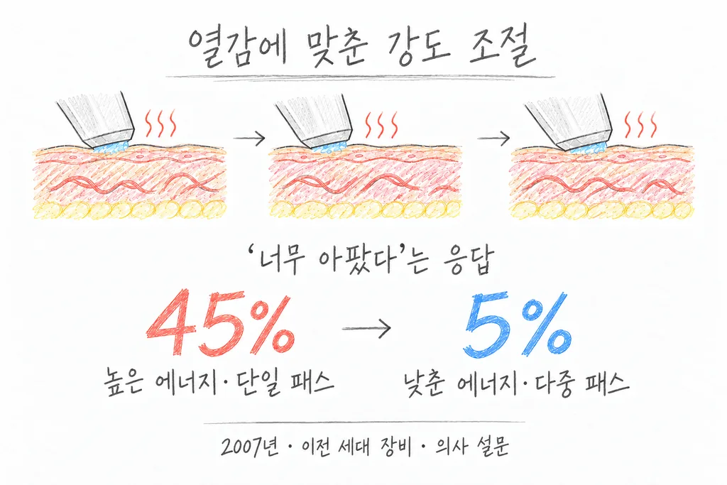 2007년 이전 세대 장비의 의사 설문에서 ‘너무 아팠다’는 비율 45%와 5%를 비교하고, 여러 패스로 시술하는 모습을 그린 도해.