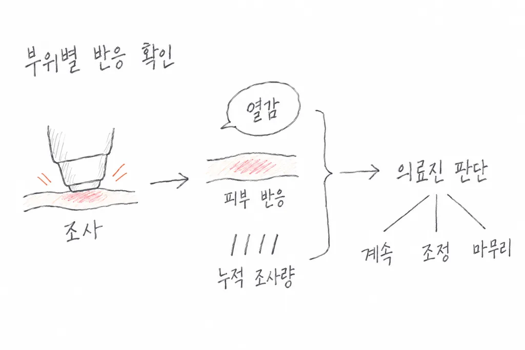조사 후 열감, 피부 반응, 누적 조사량을 함께 살핀 뒤 의료진이 계속·조정·마무리를 판단하는 흐름도
