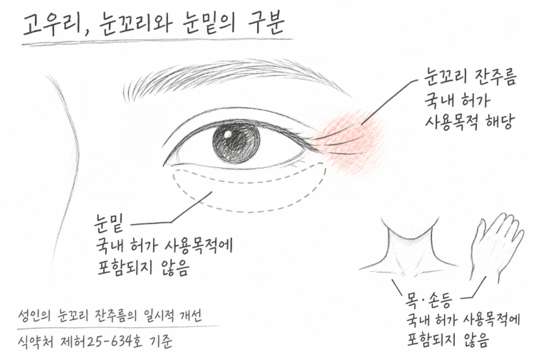 고우리는 눈가에도 할 수 있나요? 눈꼬리·눈밑 허가 범위와 주의점